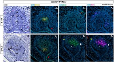 Profiles of Wnt pathway gene expression during tooth morphogenesis